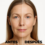 SERUM BOTOX ANTI ENVEJECIMIENTO™